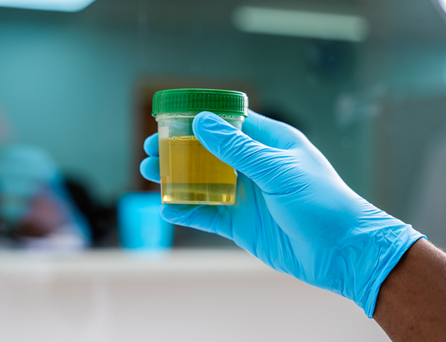 Employee of Medical Laboratory Services Curaçao holding a urine sample for testing.
